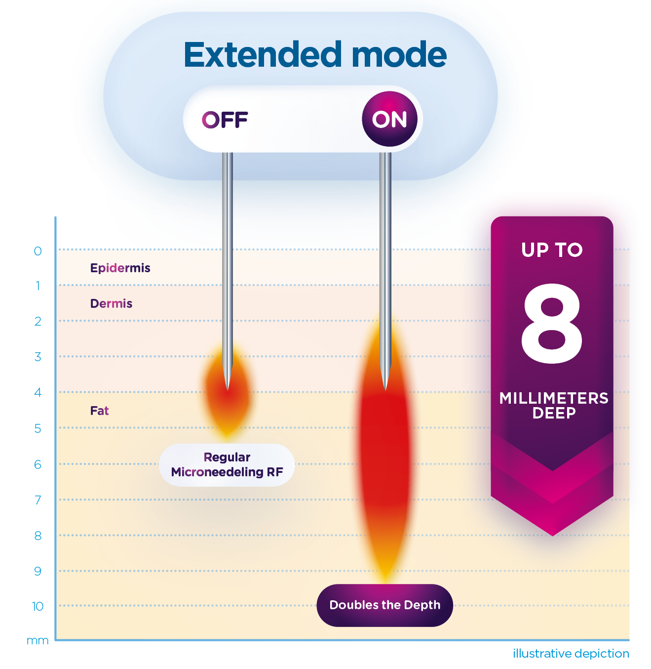 Exion_PIC_MOA_Fractional-RF_ENUS100