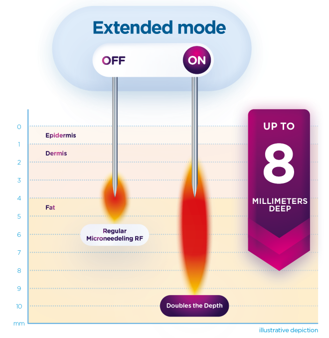 Exion_PIC_MOA_Fractional-RF_ENUS100